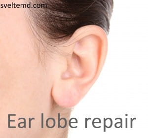 Orlando ear lobe repair
